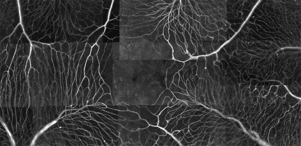 deformable mirrors in retinal 