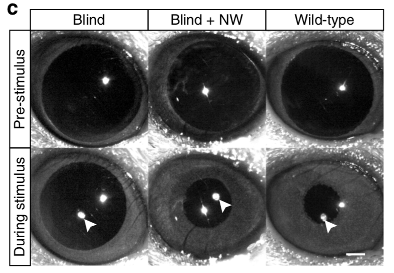 pupillary light reflex: artificial photoreceptors