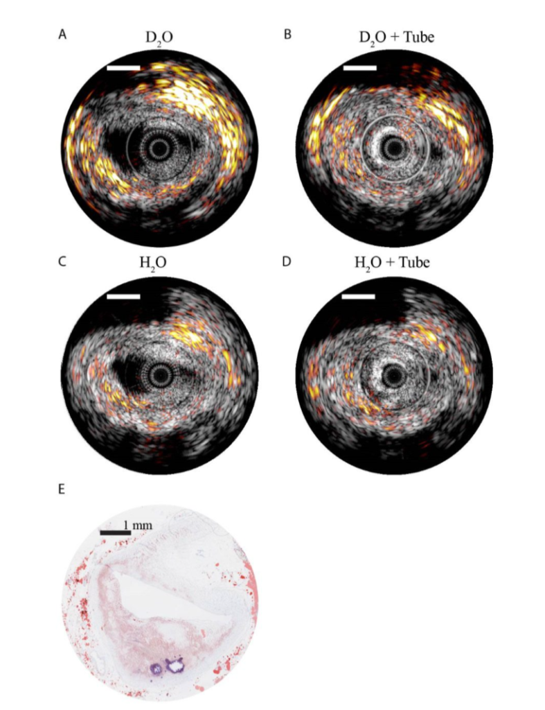 Intravascular Imaging Photoacoustic and Ultrasound Catheters for