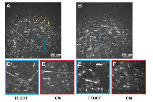 FFOCT images