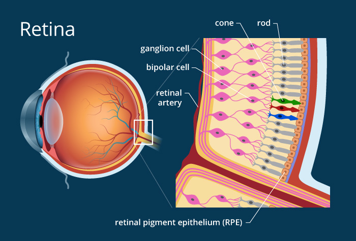 Artificial Photoreceptors: Nanowire Arrays as Subretinal Prosthetic Devices