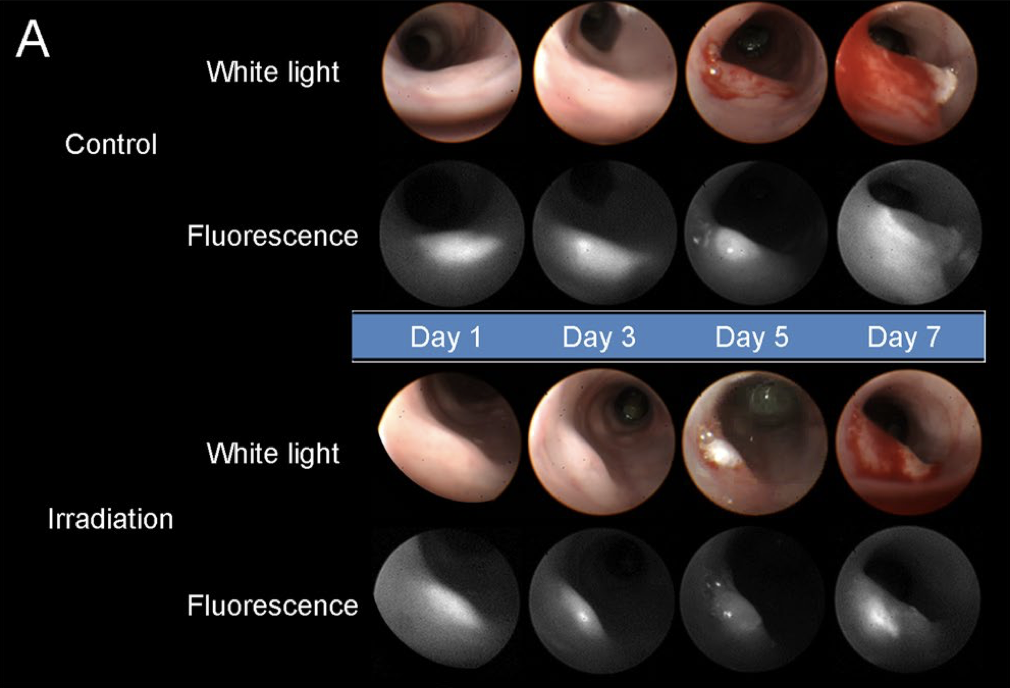 Response to laser treatment in mice