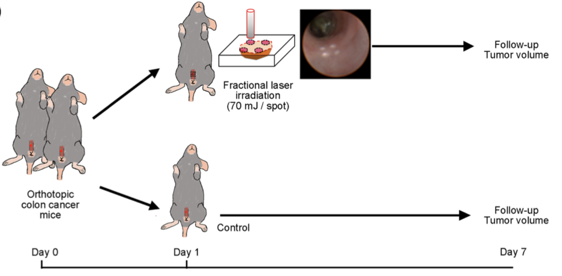 Colorectal cancer tests in mice