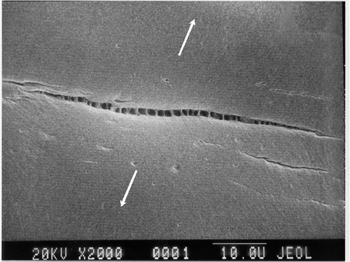 laser speckle strain imaging 