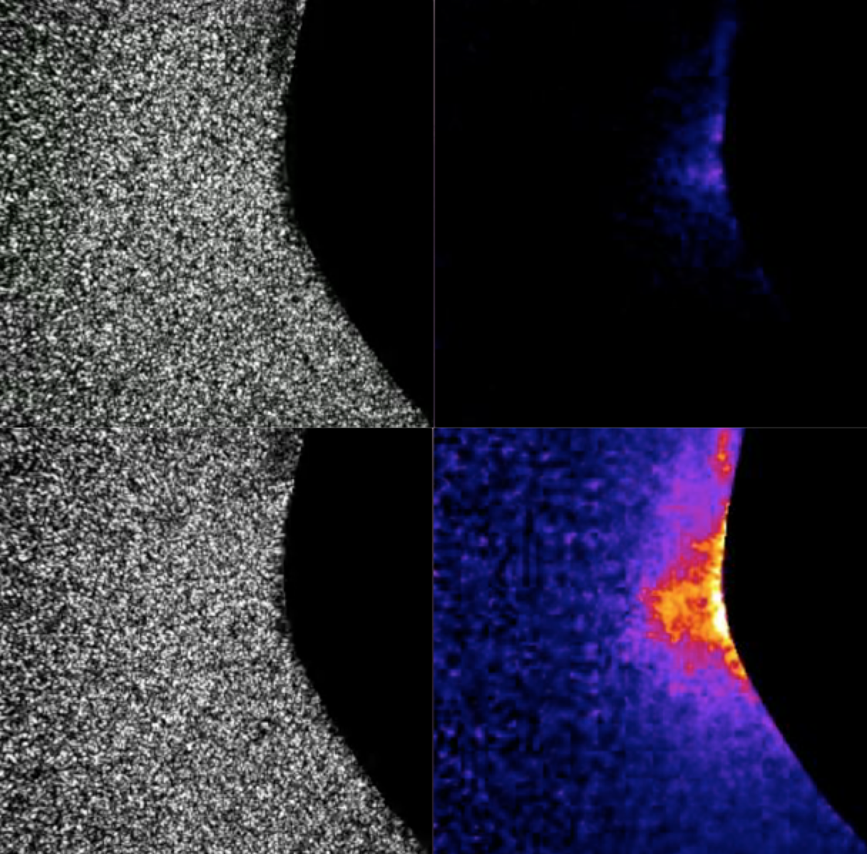 laser speckle strain imaging