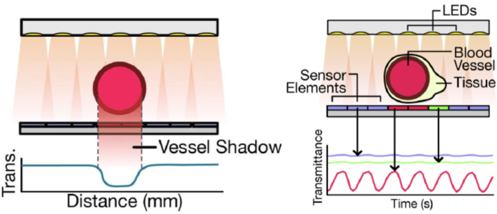 laparoscopic graspers profiles