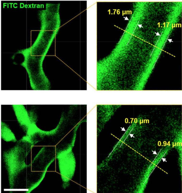 Endothelial Surface Layer Imaging