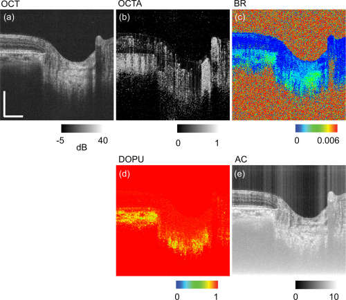 image contrasts from JM-OCT scan