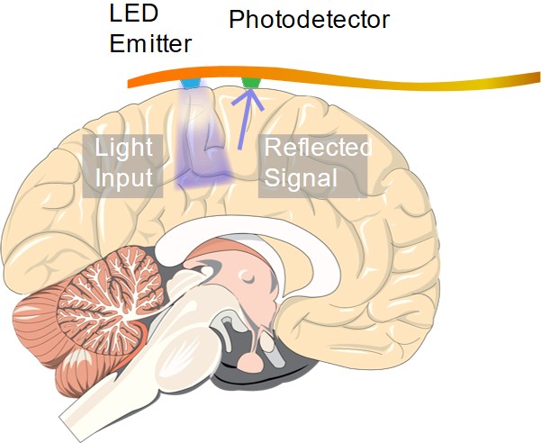 Neural imaging with an implantable ORIS sensor