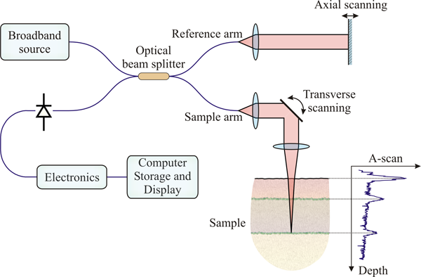 Lasers in ophthalmology