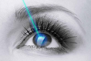 Lasers in Ophthalmology: The Future is Clear