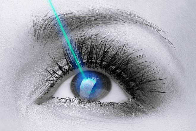 Lasers in ophthalmology: cataract surgery