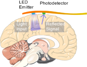 Neural Imaging with Visible Light: Implantable Optical Sensors