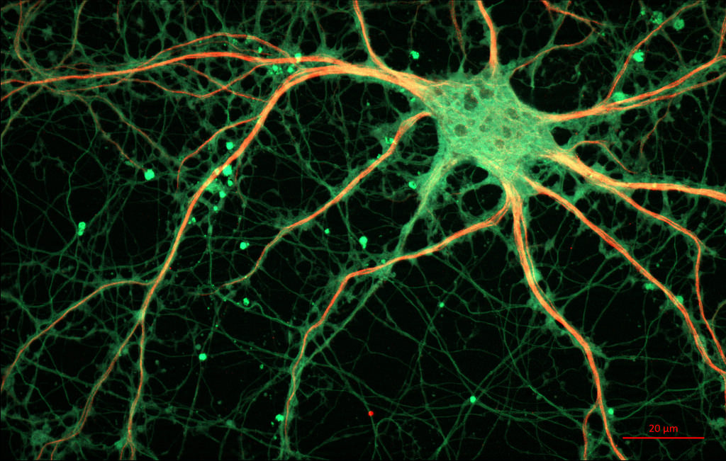 Pictured is a neuron found in the hippocampus of a rat. Photon counting is used to get an even deeper look at electrical responses in the brain.