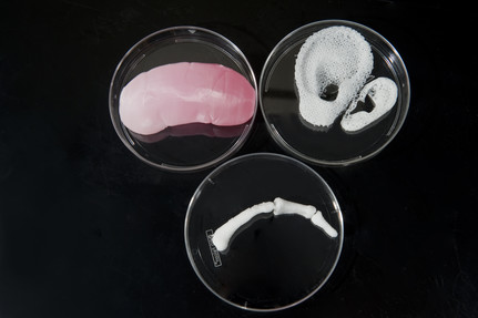 Three examples of bioprinting are shown: a kidney, ear and finger.