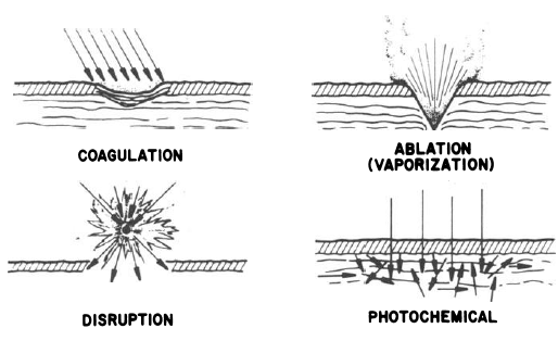 medical laser interactions