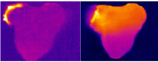 diode lasers and SSL comparision