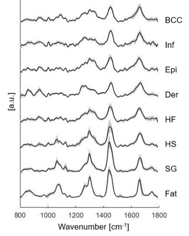 biophysical cancer analysis