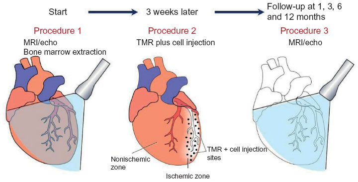 The process and timeline