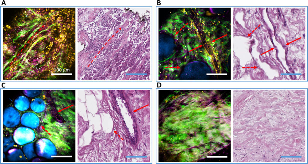 Nonlinear imaging 