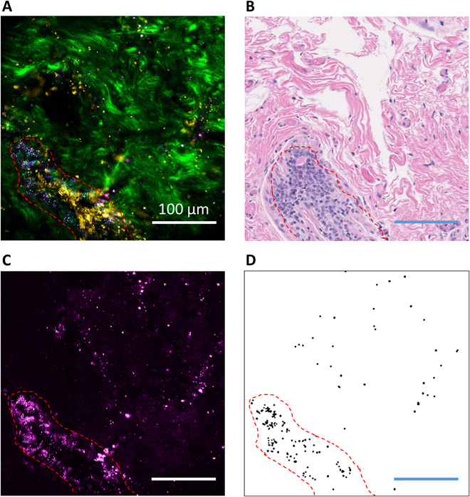 nonlinear imaging results