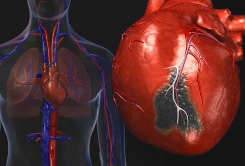 Heart anatomy and diseases