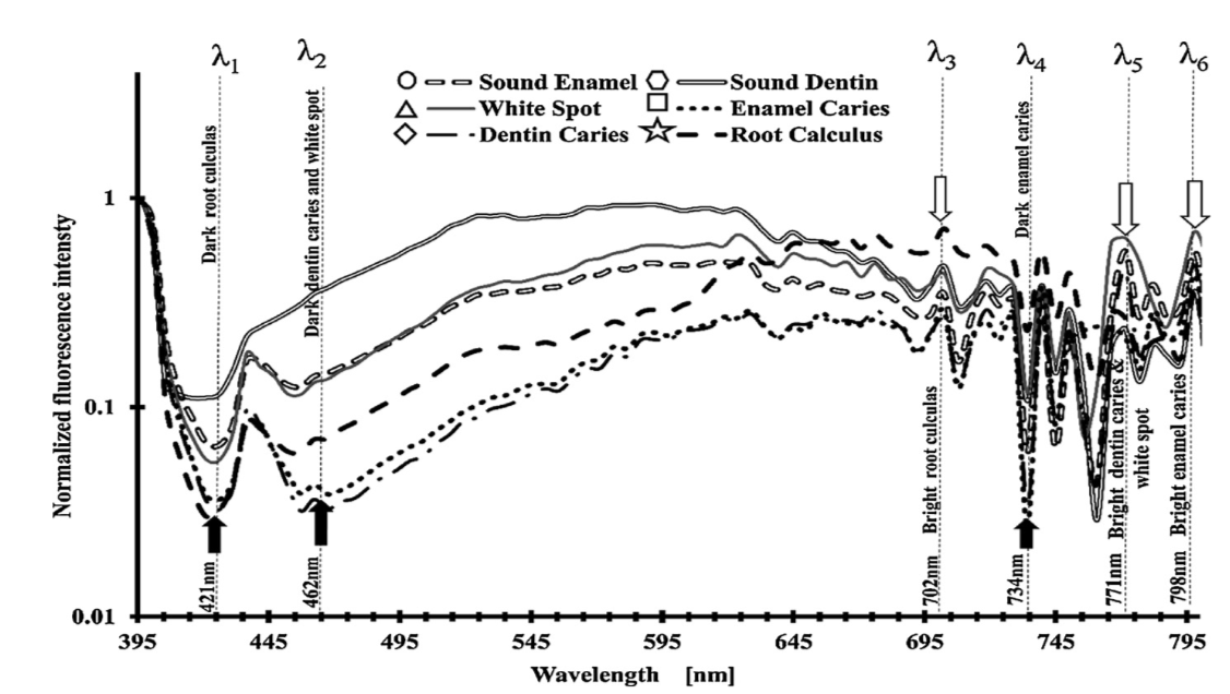 Dental Caries Diagnosis Using Fluorescence Imaging Techniques