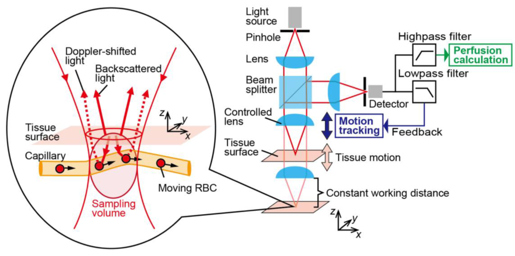 Laser doppler flowmetry setup