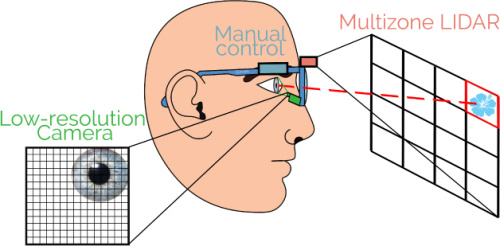 presbyopia