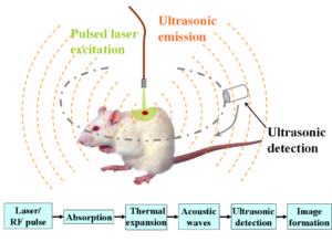 Photoacoustic Elastography: Using Light & Sound for Tissue Diagnosis