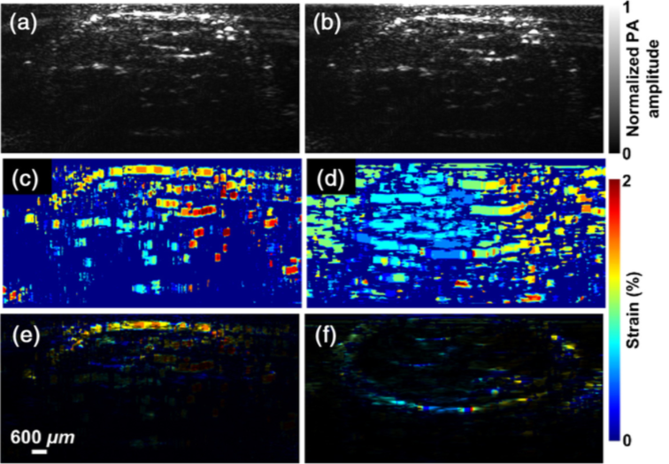 photoacoustic elastography