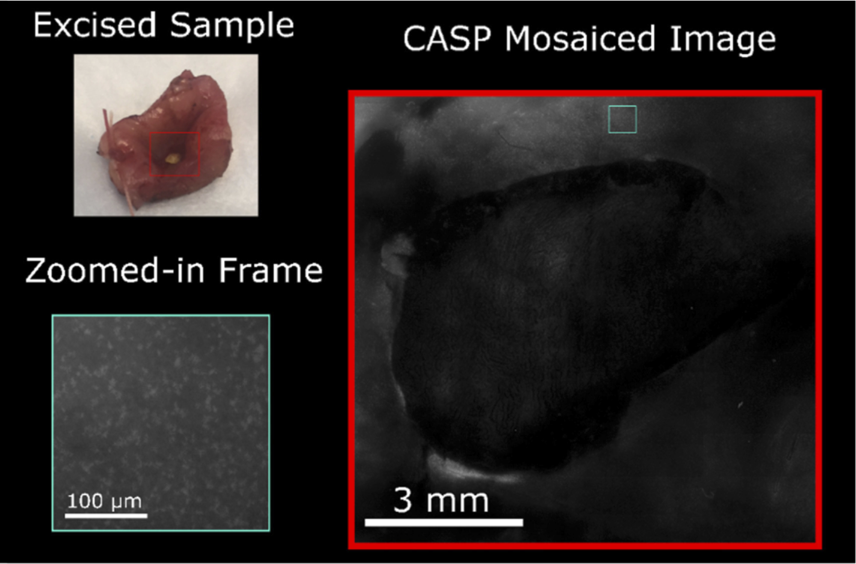 A mosaiced image of an ex-vivo sample with low grade dysplasia. Courtesy of Optics Express