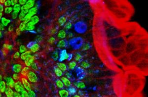 Fluorescence Microscopy: Multiphoton and Other Techniques