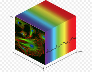 Hyperspectral Imaging for Thyroid and Salivary Gland Tumor Detection