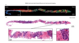 Light Sheet Microscopy- Principles and Biomed Applications