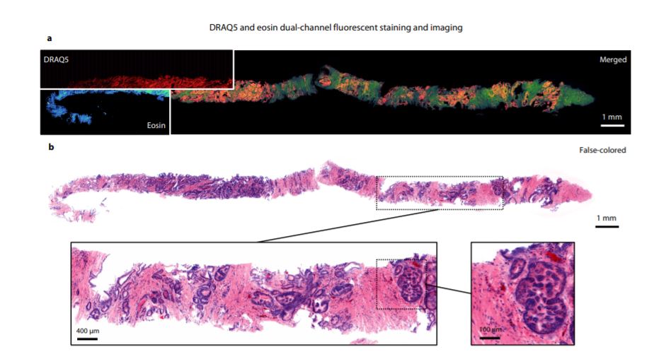 Light Sheet Microscopy Principles and Biomed Applications