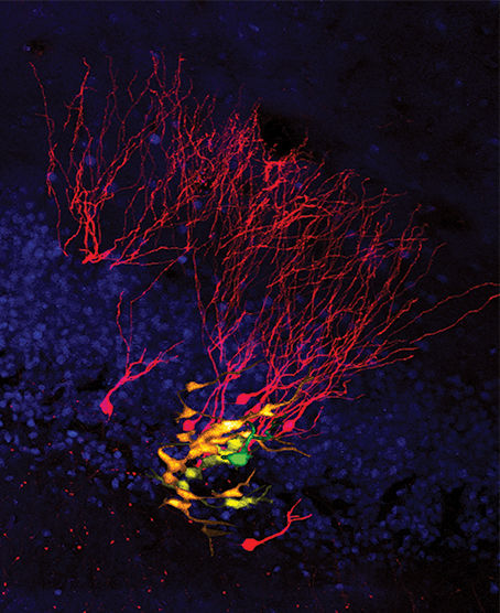 Two-photon microscopy neural stem cell
