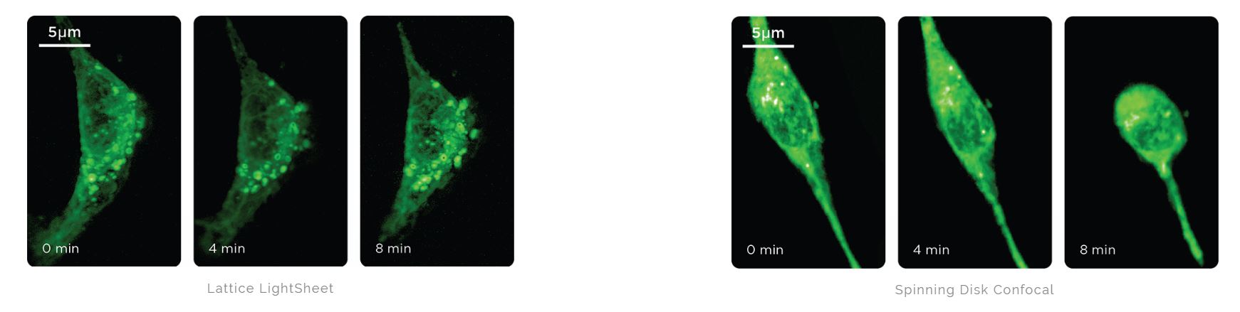 embryonic fibroblasts with LLSM and confocal microscopy