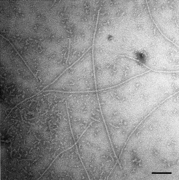 Amyloid fibrilis