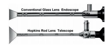 Normal glass endoscope vs Hopkins' endoscope