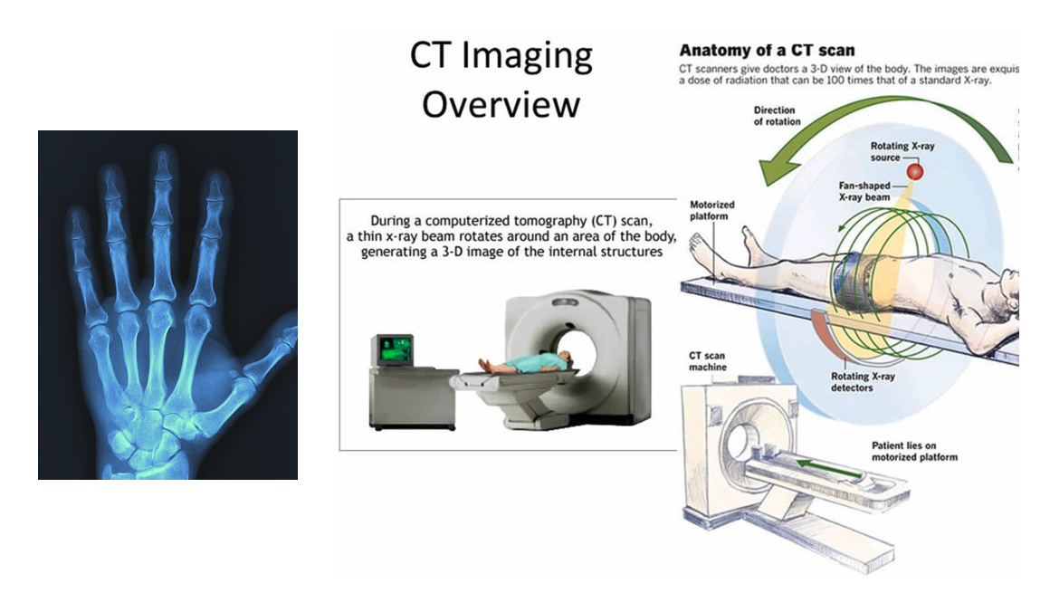 X-ray medical image