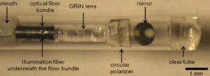 Laser Image Speckling photonics technique to diagnose heart disease