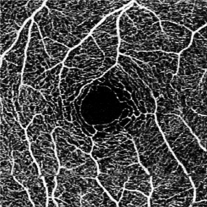 Optical Coherence Tomography: Introduction