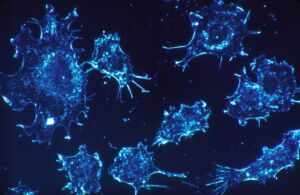 Quantum Entanglement for Medical Imaging: Advancing Cancer Diagnosis