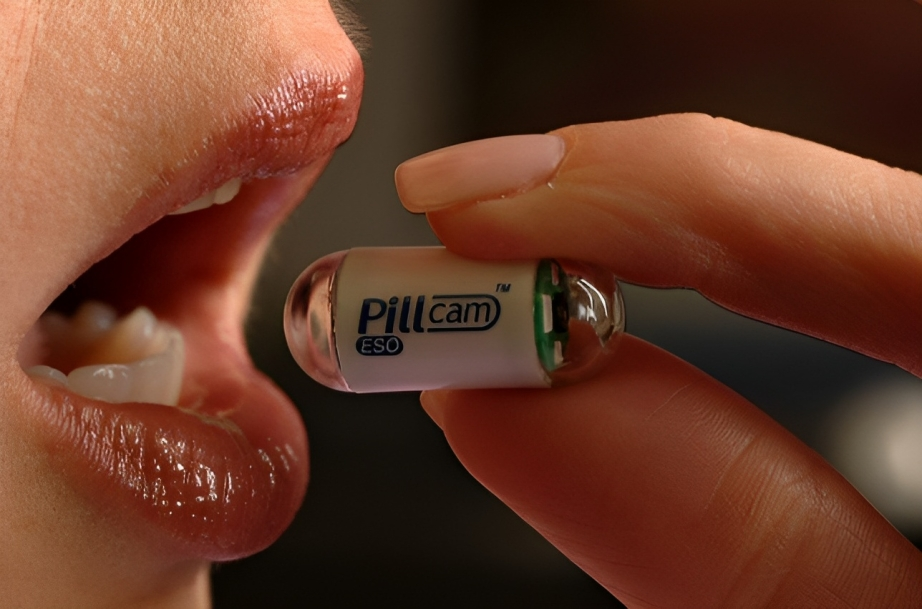 Colonoscopy Alternatives: Woman preparing to swallow an imaging camera pill for colon screening.