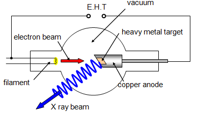 Diagram showing the generation of X-rays in a CT scanner, with an electron beam hitting a tungsten target, producing X-rays that pass through the body and are captured by detectors."