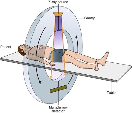 Diagram illustrating a CT scanner's rotating gantry with X-ray source and detectors capturing images from multiple angles, and the subsequent reconstruction into cross-sectional slices.