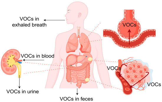 Mid-Infrared Spectroscopy disease detection